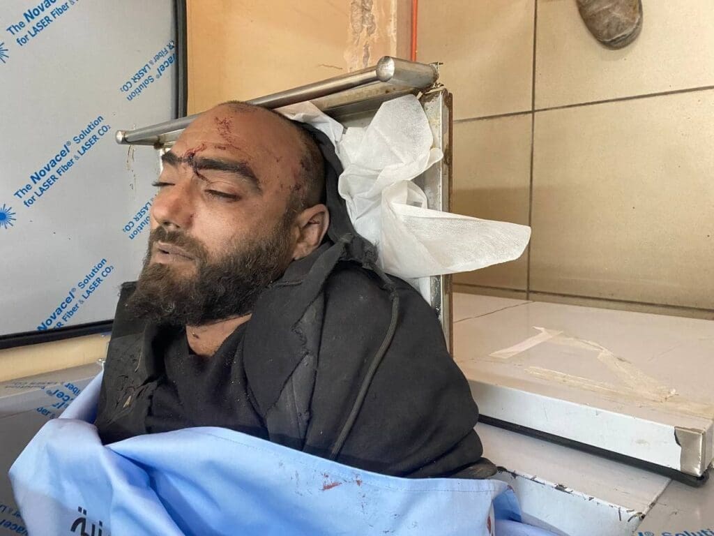 غغ