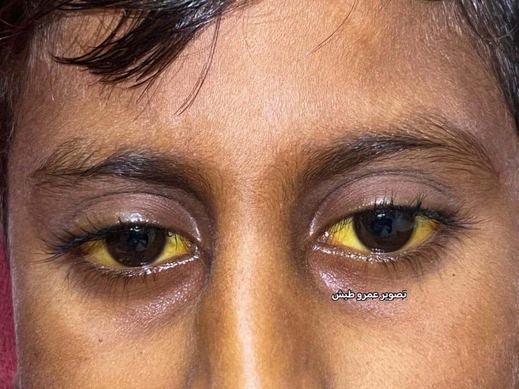 تقرير وصل الأسبوعي للعالم الإسلامي: أبرز أحداث الأسبوع الأخير من ربيع الثاني 10 1000023544