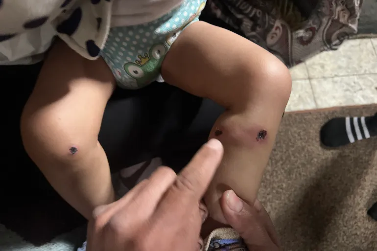 تعذيب الرضيع الفلسطيني جواد أبو نصار في قطاع غزة. 1 1 1774279926